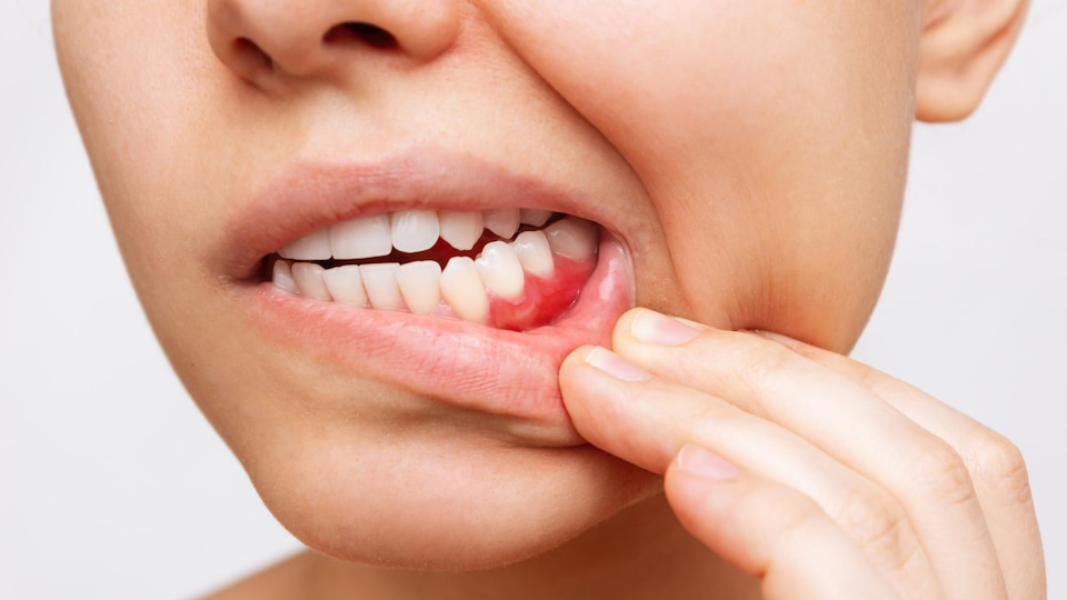 oriegn y tratamientos de la guna dental